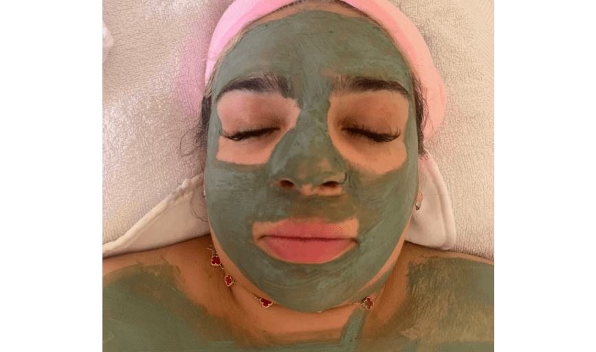 <p style="font-family: 'Poppins', sans-serif; font-weight: 700; font-size:24px;">CHEMICAL PEELS</p>